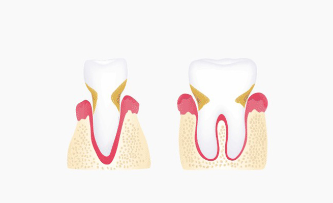 farmadent-tratamiento-blefaroplastia