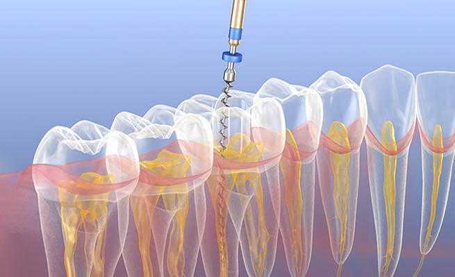 farmadent-tratamiento-CIRUGIA-ORTOGNATICA